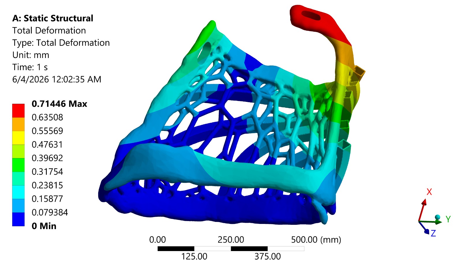 FEA of Biomedical Thumb & Wrist Bracer — Structural deformation analysis of a lattice-structured biomedical thumb and wrist bracer under static load.